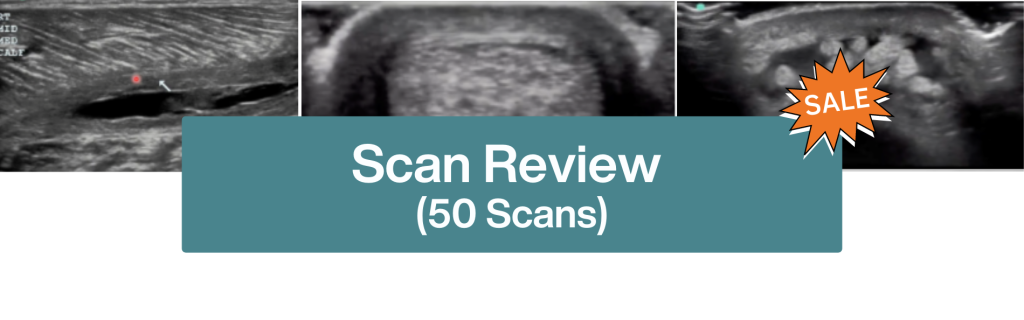Ultrasound Scan Review banner 1900 × 594 px 1