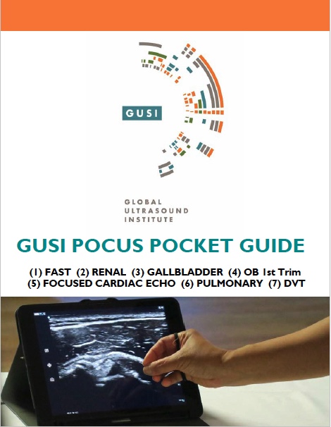 POCUS Essentials Pocket Guide From GUSI