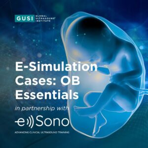E-Simulation Cases: OB Essentials