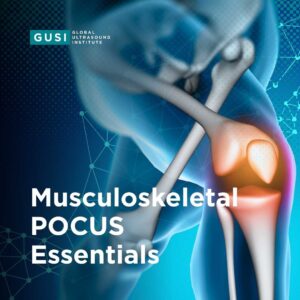 Knee effusion - Global Ultrasound Institute