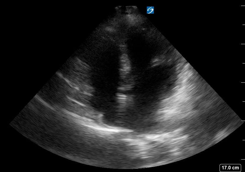 A4C Hyperdynamic3 - Video
