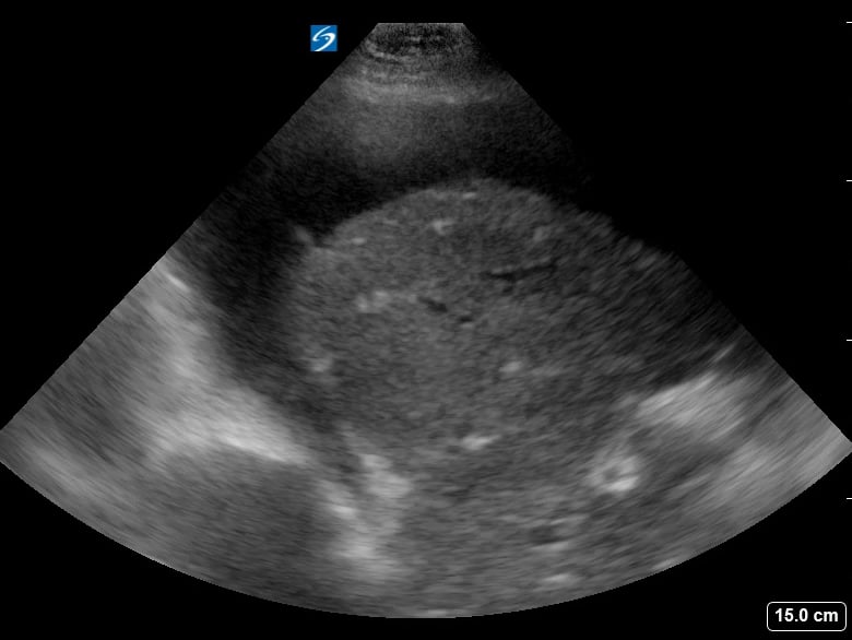 Ruq Free Fluid14 - Video