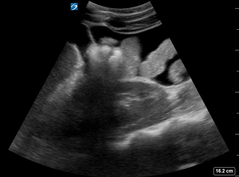 Ruq Free Fluid11 - Video