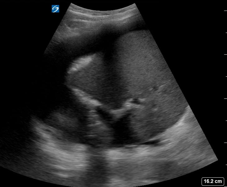 Luq Free Fluid6 - Video