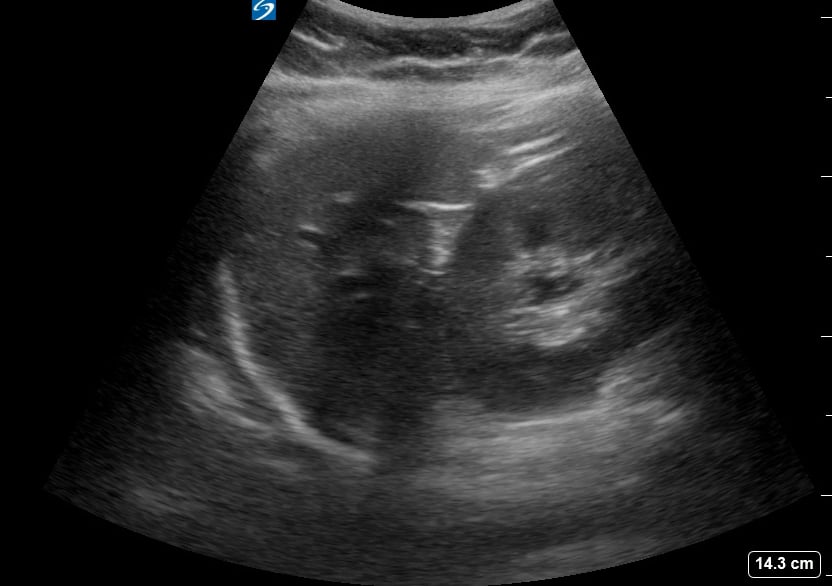 Ruq (-) Free Fluid8 - Video