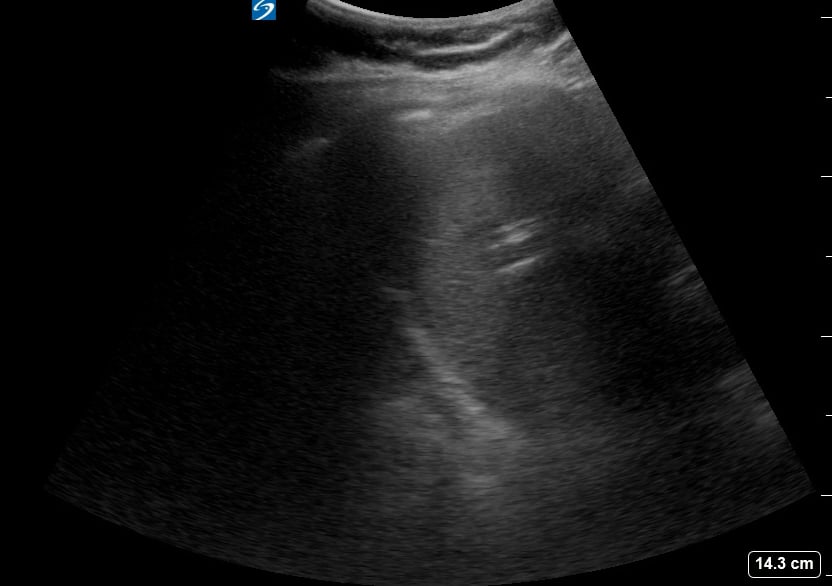 Luq (-) Free Fluid10 (Curtain Sign) - Video