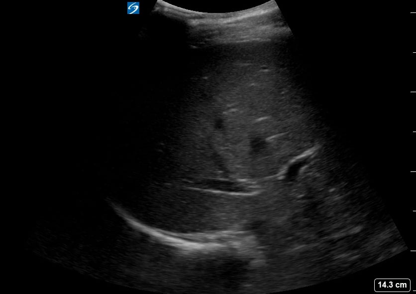 Ruq (-) Free Fluid6 - Video