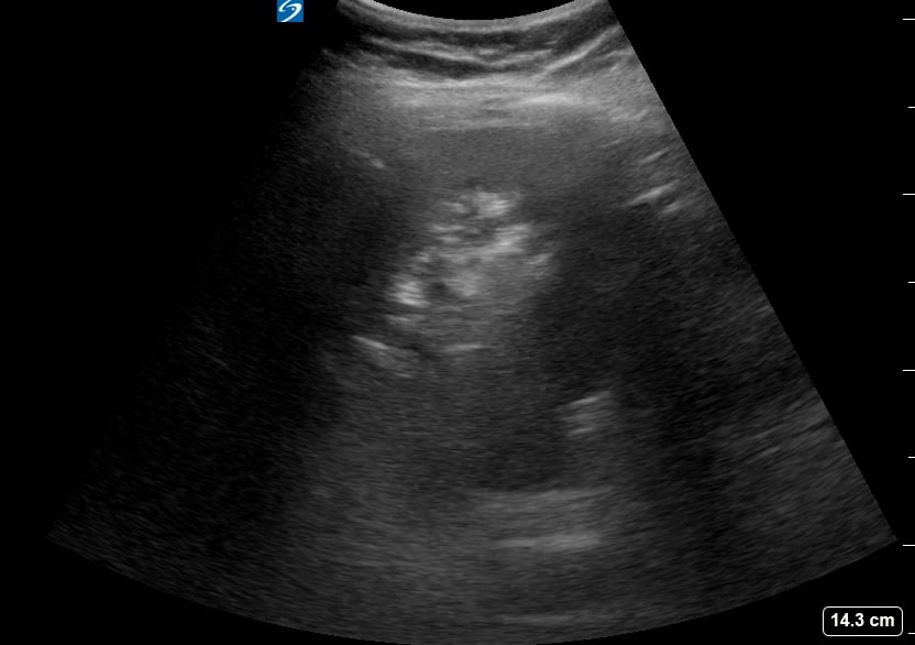 Luq (-) Free Fluid9 (Curtain Sign) - Video