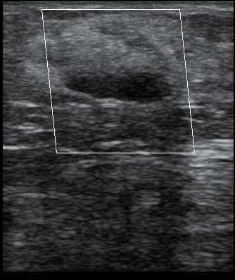 Mass: Present - Video