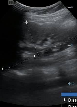 objects: Mass - Video